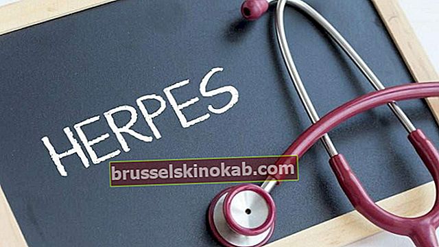 Herpes simplex: vet hur man identifierar och behandlar