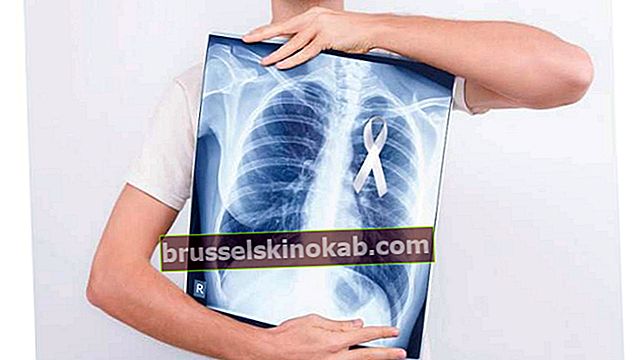Adenokarcinom, lungcancer av Ana Maria Braga, har bot?